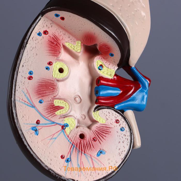 Макет "Почка человека" 14*30см